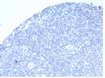 Negative Control ALPP Antibody Tonsil IHC. Immunohistochemistry analysis of FFPE human tonsil tissue stained with ALPP Antibody clone rALP/870 demonstrates minimal background HRP-DAB staining within lymphoid cellular compartments, supporting the restricted physiologic expression profile of placental alkaline phosphatase / ALPP outside trophoblast-associated tissues. This placental marker antibody shows low non-specific reactivity in normal lymphoid tissue. Antibody concentration: 2ug/ml in PBS for 30 min at RT. HIER: boil tissue sections in pH 9 10mM Tris with 1mM EDTA for 20 min and allow to cool before testing.