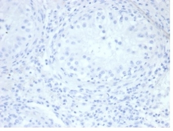 Negative Control ALPP Antibody Testis IHC. Immunohistochemistry analysis of FFPE human testis tissue stained with ALPP Antibody (clone rALP/870) demonstrates minimal detectable HRP-DAB staining within seminiferous tubules and surrounding stromal compartments, supporting the restricted physiologic expression profile of placental alkaline phosphatase / ALPP outside placental and trophoblast-associated tissues. This placental marker antibody shows low background reactivity in normal testicular tissue. Antibody concentration: 2ug/ml in PBS for 30 min at RT. HIER: boil tissue sections in pH 9 10mM Tris with 1mM EDTA for 20 min and allow to cool before testing.