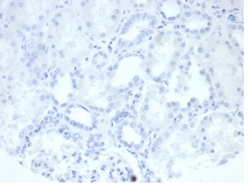 Negative Control ALPP Antibody Kidney IHC. Immunohistochemistry analysis of FFPE human kidney tissue stained with ALPP Antibody clone rALP/870 demonstrates minimal detectable HRP-DAB staining within renal tubular epithelial and stromal compartments, supporting the restricted placental-associated expression profile of placental alkaline phosphatase / ALPP in non-trophoblastic tissues. This placental marker antibody shows low background reactivity in normal renal tissue. Antibody concentration: 2ug/ml in PBS for 30 min at RT. HIER: boil tissue sections in pH 9 10mM Tris with 1mM EDTA for 20 min and allow to cool before testing.