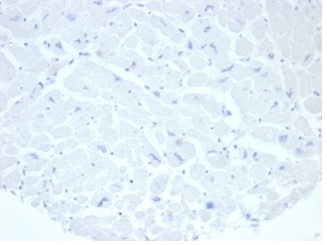 Negative Control ALPP Antibody Heart IHC. Immunohistochemistry analysis of FFPE human heart tissue stained with ALPP Antibody clone rALP/870 demonstrates minimal detectable HRP-DAB staining within cardiac myocytes and surrounding stromal tissue, supporting the restricted physiologic expression profile of placental alkaline phosphatase / ALPP outside placental and trophoblast-associated compartments. This placental marker antibody shows low non-specific background reactivity in normal cardiac tissue. Antibody concentration: 2ug/ml in PBS for 30 min at RT. HIER: boil tissue sections in pH 9 10mM Tris with 1mM EDTA for 20 min and allow to cool before testing.