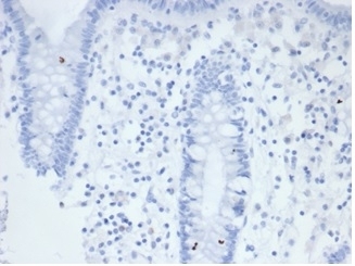 Negative Control ALPP Antibody Colon IHC. Immunohistochemistry analysis of FFPE human colon tissue stained with ALPP Antibody clone rALP/870 demonstrates minimal detectable HRP-DAB staining within colonic epithelial and stromal compartments, supporting the restricted placental-associated expression profile of placental alkaline phosphatase / ALPP in non-trophoblastic tissues. This placental marker antibody shows low background reactivity in normal gastrointestinal epithelium. Antibody concentration: 2ug/ml in PBS for 30 min at RT. HIER: boil tissue sections in pH 9 10mM Tris with 1mM EDTA for 20 min and allow to cool before testing.
