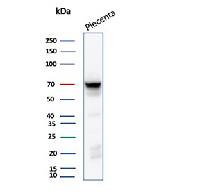 ALPP Antibody Placenta WB. Western blot analysis of human placenta tissue lysate using ALPP Antibody / Placental Alkaline Phosphatase Antibody (clone rALP/870) detects a strong band at approximately 68-70 kDa, consistent with the expected apparent molecular weight range of placental alkaline phosphatase / ALPP. Although the predicted molecular weight of ALPP is lower, the protein is commonly observed at higher apparent molecular weights due to extensive glycosylation and post-translational modification characteristic of this membrane-associated alkaline phosphatase family member.
