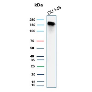 Recombinant MSH6 Antibody MSH6/7065R in Human DU145 Prostate Cancer Cells WB. Western blot testing of Recombinant MSH6 Antibody, clone MSH6/7065R, in human DU145 prostate cancer cell lysate. A prominent band is detected at approximately 160 kDa, consistent with the predicted molecular weight of MSH6. This Recombinant MSH6 Antibody demonstrates detection of the DNA mismatch repair protein in human prostate cancer cells.