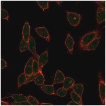 ZC3H7A Antibody HeLa IF. Immunofluorescence analysis of PFA-fixed human HeLa cells using ZC3H7A Antibody / RNA Processing Factor Antibody clone PCRP-ZC3H7A-1D6 demonstrates prominent green fluorescence throughout the cytoplasm with additional signal extending into the perinuclear region, consistent with the reported role of Zinc finger CCCH-type containing 7A (ZC3H7A) as an RNA-binding protein involved in RNA metabolism and post-transcriptional gene regulation. The staining pattern highlights the intracellular distribution expected for a protein associated with RNA processing complexes and messenger RNA regulatory pathways. Cellular architecture is visualized using phalloidin (red), which labels filamentous actin and outlines cell morphology. This immunofluorescence staining pattern supports studies of RNA processing factor biology, RNA-binding protein function, and post-transcriptional regulatory mechanisms in human cells. ZC3H7A antibody is shown in green and phalloidin is shown in red.