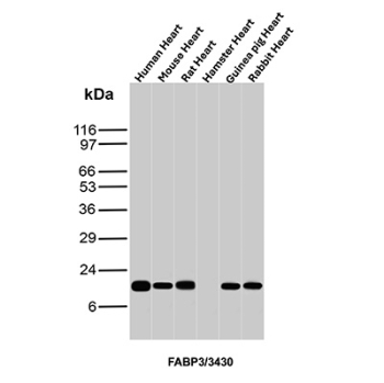 FABP3 Antibody Multi-Species Heart Tissue WB. Western blot analysis of human heart, mouse heart, rat heart, hamster heart, guinea pig heart, and rabbit heart tissue lysates using FABP3 Antibody clone FABP3/3430. A prominent band is detected at approximately 15 kDa in all tested cardiac tissue samples, consistent with the predicted molecular weight of Fatty acid-binding protein 3 / FABP3. The highly conserved cross-species cardiac expression pattern is consistent with the established role of FABP3 in intracellular fatty acid transport, myocardial lipid utilization, and oxidative energy metabolism within cardiomyocytes.