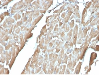 FABP3 Antibody FFEP Human Heart Tissue IHC. Immunohistochemistry analysis of FFPE human heart tissue stained with clone FABP3/3430. Cardiomyocytes exhibit diffuse cytoplasmic HRP-DAB brown staining for Fatty acid-binding protein 3 / FABP3, consistent with the known enrichment of this intracellular lipid transport protein in metabolically active cardiac muscle. The staining pattern supports the established role of FABP3 in myocardial fatty acid utilization and oxidative bioenergetics within cardiomyocytes. Hematoxylin counterstain highlights nuclei in blue. HIER: boil tissue sections in pH9 10 mM Tris with 1 mM EDTA for 20 min followed by cooling before testing.