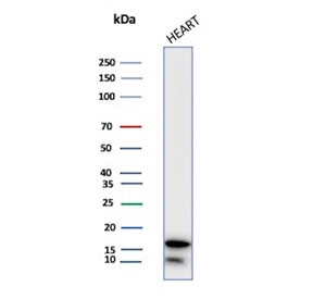 FABP3 Antibody Heart WB. Western blot analysis of human heart lysate using FABP3 Antibody. A dominant band is detected at approximately 14-15 kDa, consistent with the predicted molecular weight of Fatty acid-binding protein 3 / FABP3. A faint lower migrating band is also observed and may represent minor proteolytic processing or a faster-migrating low molecular weight species. The prominent cardiac signal aligns with the established enrichment of FABP3 in cardiomyocytes and its role in intracellular fatty acid transport and oxidative energy metabolism.