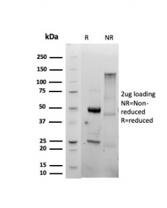 SDS-PAGE analysis of purified, BSA-free CD86 antibody (clone C86/6500R) as confirmation of integrity and purity.