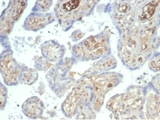 AFP Antibody Human Placenta IHC. Immunohistochemistry staining of FFPE human placental tissue with recombinant AFP antibody (clone rAFP/7257) at 2ug/ml in PBS for 30min RT. Cytoplasmic staining observed. HIER: boil tissue sections in pH 9 10mM Tris with 1mM EDTA for 20 min and allow to cool before testing.