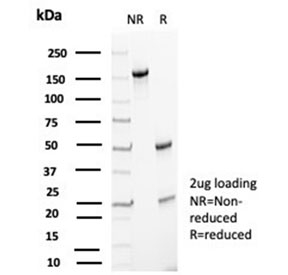 SDS-PAGE analysis of purified, BSA-free p27Kip1 antibody (clone KIP1/1357) as confirmation of integrity and purity.