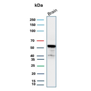 Recombinant ALDH1A1 Antibody Brain WB. Western blot testing of human brain tissue lysate using recombinant ALDH1A1 antibody (clone rALDH1A1/7285). Expected molecular weight ~55 kDa.