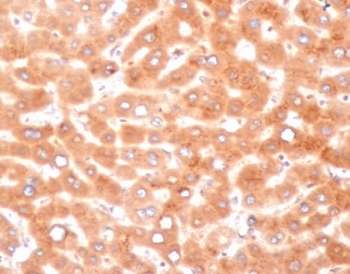 Alpha-1-Antichymotrypsin Antibody Human Liver IHC. Immunohistochemistry analysis of FFPE human liver tissue with Alpha-1-Antichymotrypsin antibody (clone SERPINA3/4187). HIER: boil tissue sections in pH 9 10mM Tris with 1mM EDTA for 20 min and allow to cool before testing.
