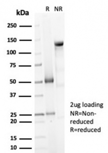 SDS-PAGE analysis of purified, BSA-free DCN antibody rabbit monoclonal (clone DCN/7031R) as confirmation of integrity and purity.