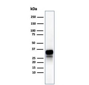 GZMB Antibody Human Spleen WB. Western blot analysis of human spleen tissue lysate using GZMB Antibody. An HRP-conjugated secondary antibody with ECL substrate was used for detection. GZMB Antibody, recognizing Granzyme B, detects prominent bands within the expected 29-37 kDa molecular weight range, consistent with precursor and proteolytically processed forms of granzyme B. The higher molecular weight band likely represents the inactive proenzyme, while the lower band corresponds to the mature active enzyme.