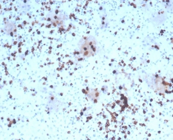 GZMB Antibody Human Tonsil IHC. Immunohistochemical staining of FFPE human tonsil tissue using GZMB Antibody. HIER was performed in pH 9 Tris-EDTA buffer. An HRP-conjugated secondary antibody with DAB substrate was used for detection. GZMB Antibody, recognizing Granzyme B, demonstrates strong granular cytoplasmic staining in scattered lymphocytes within the tonsillar lymphoid tissue, consistent with granzyme B expression in activated cytotoxic T lymphocytes and natural killer cells.