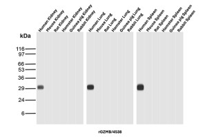 GZMB Antibody in Multi-Species Kidney, Lung and Spleen WB. Western blot testing of GZMB Antibody / Granzyme B in kidney, lung and spleen tissue lysates from human, mouse, rat, hamster, guinea pig and rabbit. A strong band is observed at approximately 29-30 kDa in human kidney, human lung and human spleen, while no corresponding band is detected in the tested mouse, rat, hamster, guinea pig or rabbit tissues. This GZMB Antibody demonstrates detection of endogenous Granzyme B in the tested human tissues.