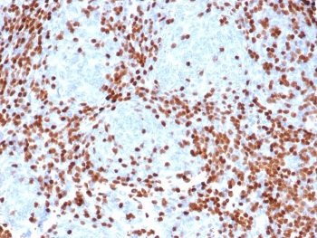 Immunohistochemistry of DNTT antibody in human thymus tissue. Formalin-fixed, paraffin-embedded human thymus shows strong nuclear staining in immature thymocytes, consistent with Terminal deoxynucleotidyl transferase expression in developing lymphoid cells. Heat-induced epitope retrieval was performed by boiling tissue sections in pH 9 10mM Tris with 1mM EDTA for 20 minutes followed by cooling prior to staining. The mouse recombinant monoclonal antibody clone rDNTT/6909 was used as the primary antibody, demonstrating distinct nuclear localization in cortical thymic lymphoblasts.