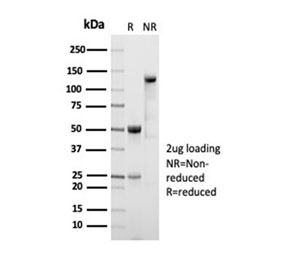 SDS-PAGE analysis of purified, BSA-free recombinant Aldehyde Dehydrogenase 1A1  antibody (clone ALDH1A1/7011R) as confirmation of integrity and purity.