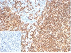 IHC staining of FFPE human tonsil tissue with recombinant CD20 antibody (clone rMS4A1/7280) at 2ug/ml. Negative control inset: PBS instead of primary antibody to control for secondary binding. HIER: boil tissue sections in pH 9 10mM Tris with 1mM EDTA for 20 min and allow to cool before testing.