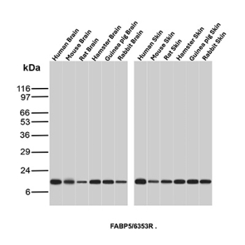 Fatty Acid Binding Protein 5 Antibody Multi-Species Brain and Skin WB. Western blot analysis of human brain, mouse brain, rat brain, hamster brain, guinea pig brain, rabbit brain, human skin, mouse skin, rat skin, hamster skin, guinea pig skin, and rabbit skin tissue lysates using Fatty acid-binding protein 5 antibody clone FABP5/6353R. A band is detected at approximately 15 kDa across brain and skin samples from multiple mammalian species, consistent with the predicted molecular weight of Fatty acid-binding protein 5 / FABP5. The conserved expression pattern aligns with the established role of FABP5 in epidermal lipid transport, keratinocyte fatty acid metabolism, and neural lipid signaling pathways.