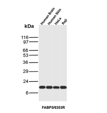 Fatty Acid Binding Protein 5 Antibody Cell and Tissue WB. Western blot analysis of human brain, human skin, HeLa, and Raji lysates using Fatty acid-binding protein 5 antibody clone FABP5/6353R. A clear band is detected at approximately 15 kDa across all tested samples, consistent with the predicted molecular weight of Fatty acid-binding protein 5 / FABP5. The observed expression pattern is consistent with the known role of FABP5 in epidermal lipid transport, fatty acid metabolism, and cellular lipid signaling within epithelial and proliferative cell populations.
