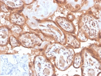 IHC staining of FFPE human placental tissue with Fibroblast Activation Protein Alpha antibody (clone FAP/4853). Negative control inset: PBS instead of primary antibody to control for secondary binding. HIER: boil tissue sections in pH 9 10mM Tris with 1mM EDTA for 20 min and allow to cool before testing.