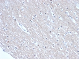 SATB2 Antibody Recombinant Mouse MAb Brain IHC. Immunohistochemistry of SATB2 antibody in FFPE human brain tissue. The recombinant mouse monoclonal SATB2 antibody (clone rSATB2/6929) demonstrates nuclear staining in scattered neuronal cells, consistent with SATB2 expression in cortical neuron populations. Background staining is minimal. Heat-induced epitope retrieval was performed by boiling sections in pH 9 10mM Tris with 1mM EDTA for 20 minutes followed by cooling prior to incubation with the primary antibody at 2 ug/ml for 30 minutes at room temperature.