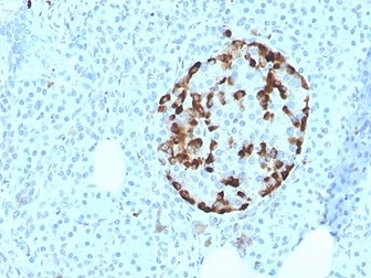 VDBP Antibody Pancreatic Islet IHC. Immunohistochemistry analysis of FFPE human pancreatic tissue stained with VDBP Antibody clone VDBP/4481 demonstrates strong cytoplasmic HRP-DAB brown staining within islet-associated endocrine cell populations, consistent with the role of Vitamin D binding protein / VDBP in endocrine metabolism, circulating transport physiology, and vitamin D-associated regulatory pathways. The concentrated staining pattern within pancreatic endocrine structures aligns with the biologic importance of vitamin D-associated signaling in metabolic homeostasis and endocrine tissue function. Tissue sections were stained using 2 ug/ml antibody in PBS for 30 min at room temperature. HIER: boil tissue sections in pH 9 10mM Tris with 1mM EDTA for 20 min and allow to cool before testing.