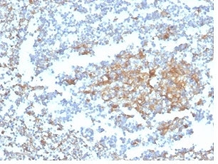 Vitamin D binding protein Antibody Tonsil IHC. Immunohistochemistry staining of FFPE human tonsil tissue with Vitamin D binding protein antibody (clone VDBP/4482) at 2ug/ml in PBS for 30min RT. HIER: boil tissue sections in pH 9 10mM Tris with 1mM EDTA for 20 min and allow to cool before testing.