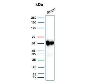 Western blot testing of human brain tissue with GFAP antibody. Predicted molecular weight ~50 kDa.