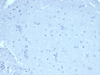 Negative control: IHC staining of FFPE human brain tissue using FOXP1 antibody (clone rFOXP1/6902) at 1ug/ml in PBS for 30min RT. HIER: boil tissue sections in pH 9 10mM Tris with 1mM EDTA for 20 min and allow to cool before testing.