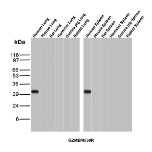 Recombinant Granzyme B Antibody in Multi-Species Lung and Spleen WB. Western blot testing of Recombinant Granzyme B Antibody in lung and spleen tissue lysates from human, mouse, rat, hamster, guinea pig and rabbit. A strong, discrete band is observed at approximately 31-32 kDa in human lung and human spleen, while no corresponding band is detected in the tested mouse, rat, hamster, guinea pig or rabbit tissues. This Recombinant Granzyme B Antibody demonstrates detection of endogenous Granzyme B in the tested human tissues.
