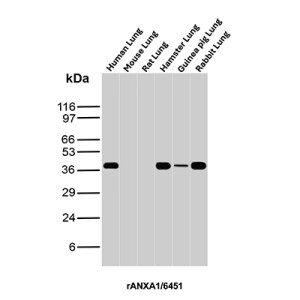 ANXA1 Antibody Human, Mouse, Rat, Hamster, Guinea Pig and Rabbit Lung WB. Western blot analysis of human, mouse, rat, hamster, guinea pig and rabbit lung tissue lysates using ANXA1 Antibody (clone rANXA1/6451). Annexin A1 is detected at approximately 37-40 kDa in human, hamster, guinea pig and rabbit lung tissue, with little to no detectable signal observed in the mouse and rat samples under these conditions.