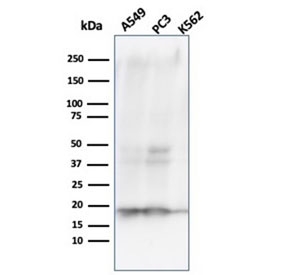 Western blot analysis of human A549, PC3 and K562 cell lysates using NM23 antibody (clone NME1/2738). Predicted molecular weight ~17 kDa.