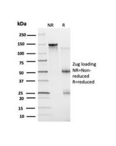 SDS-PAGE analysis of purified, BSA-free Bcl6 antibody (clone PCRP-BCL6-1D3) as confirmation of integrity and purity.