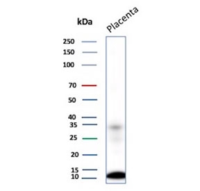 Western blot testing of human placental tissue lysate with MCP2 antibody. Predicted molecular weight ~11 kDa, higher molecular weight bands may represent dimerization.