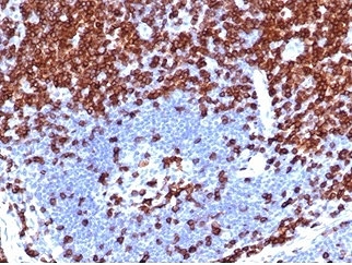 CD5 Antibody for IHC. Immunohistochemistry analysis of CD5 antibody staining in FFPE human lymph node tissue using a tumor immune microenvironment marker antibody, clone C5/4561R. Strong membranous staining is observed in T lymphocytes within paracortical regions, with dense labeling of T cell-rich zones surrounding follicles, while germinal center B cell areas remain largely negative. The staining pattern highlights lymph node architecture and reflects the role of CD5 in identifying T cell populations relevant to immune infiltration and tissue-based immune context. Heat-induced epitope retrieval was performed using pH 9 Tris-EDTA buffer for 20 minutes followed by cooling prior to antibody incubation.