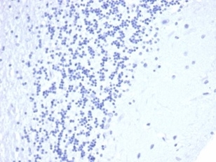 Negative control: IHC staining of FFPE human brain with recombinant CD5 antibody (clone C5/4561R) at 2ug/ml in PBS for 30min RT. HIER: boil tissue sections in pH 9 10mM Tris with 1mM EDTA for 20 min and allow to cool before testing.