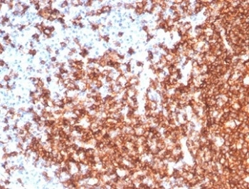 Immunohistochemistry analysis of CD20 Antibody Rabbit Monoclonal in human tonsil tissue. FFPE human tonsil demonstrates strong membranous HRP-DAB brown staining in B lymphocytes within germinal centers and follicular regions, consistent with CD20/MS4A1 surface expression, while adjacent non-B-cell areas show minimal staining. Antigen retrieval was performed by boiling tissue sections in pH 9 10mM Tris with 1mM EDTA for 20 minutes followed by cooling prior to incubation with recombinant CD20 antibody (clone MS4A1/7015R).