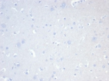 Negative control: IHC staining of FFPE human brain tissue with CD20 antibody (clone MS4A1/7015R) at 2ug/ml in PBS for 30min RT. HIER: boil tissue sections in pH 9 10mM Tris with 1mM EDTA for 20 min and allow to cool before testing.