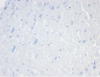 Negative control: IHC staining of FFPE human heart tissue with CD20 antibody (clone MS4A1/7015R) at 2ug/ml in PBS for 30min RT. HIER: boil tissue sections in pH 9 10mM Tris with 1mM EDTA for 20 min and allow to cool before testing.
