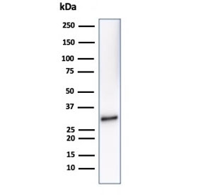 Western blot testing of human Raji cell lysate using CD20 antibody (clone MS4A1/7015R). Predicted molecular weight ~33 kDa.