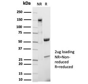 SDS-PAGE analysis of purified, BSA-free CD20 antibody (clone MS4A1/7015R) as confirmation of integrity and purity.