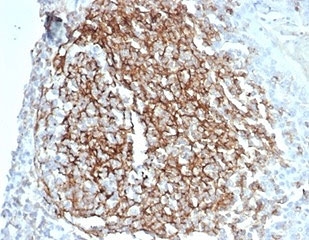 IHC staining of FFPE human spleen tissue with recombinant CD35 antibody (clone CD35/7016R) at 2ug/ml. HIER: boil tissue sections in pH 9 10mM Tris with 1mM EDTA for 20 min and allow to cool before testing.