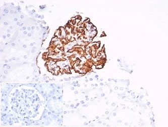 IHC staining of FFPE human tonsil tissue with recombinant CD35 antibody (clone CD35/7016R) at 2ug/ml. Negative control inset: PBS used instead of primary antibody to control for secondary Ab binding. HIER: boil tissue sections in pH 9 10mM Tris with 1mM EDTA for 20 min and allow to cool before testing.