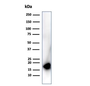 CDKN2A Antibody HepG2 WB. Western blot testing of human HepG2 cell lysate using CDKN2A antibody (clone rCDKN2A/4845). Predicted molecular weight ~16 kDa.
