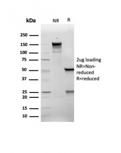 SDS-PAGE analysis of purified, BSA-free recombinant p21WAF1 antibody (clone rCIP1/6907) as confirmation of integrity and purity.