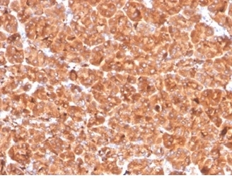 Cathepsin D Antibody Pancreas Tissue IHC. Immunohistochemistry analysis of FFPE human pancreas tissue using Cathepsin D antibody (clone CTSD/4497) shows diffuse granular cytoplasmic staining in pancreatic cells, consistent with CTSD / Cathepsin D localization in lysosomal compartments. The punctate staining pattern reflects lysosomal protease distribution associated with intracellular protein processing and turnover. Tissue architecture is preserved, and surrounding stromal regions display comparatively lower staining. Hematoxylin counterstain provides nuclear contrast and structural context. HIER: boil FFPE tissue sections in pH 9 10 mM Tris with 1 mM EDTA for 20 min and allow to cool before testing.