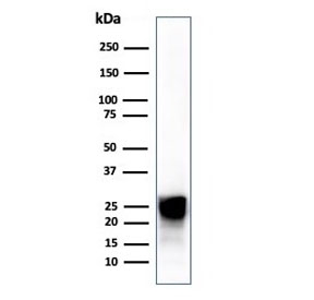 CTSD Antibody Human Liver Immunoblot. Western blot testing of human liver tissue lysate using CTSD antibody (clone CTSD/4497).