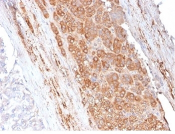 Apolipoprotein E Antibody Human Adrenal Gland IHC. Immunohistochemical staining of FFPE human adrenal gland tissue with Apolipoprotein E antibody (clone APOE/3671). Heat-induced epitope retrieval (HIER) was performed by boiling tissue sections in pH 9, 10 mM Tris with 1 mM EDTA for 20 minutes and allowing them to cool prior to staining. Apolipoprotein E immunoreactivity is observed predominantly within the cytoplasm and along the cell membranes of adrenal cortical cells, consistent with the expected localization of this lipid transport protein involved in cholesterol homeostasis and lipoprotein metabolism. Cell nuclei are counterstained with hematoxylin (blue).